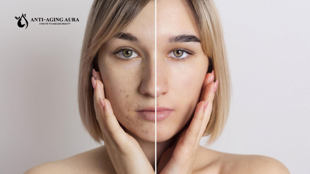 before and after using organic retinol cream for anti-aging aura