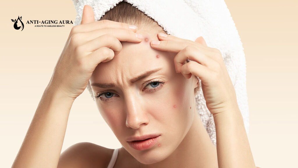anti-aging aura organic retinol cream for acne and breakouts